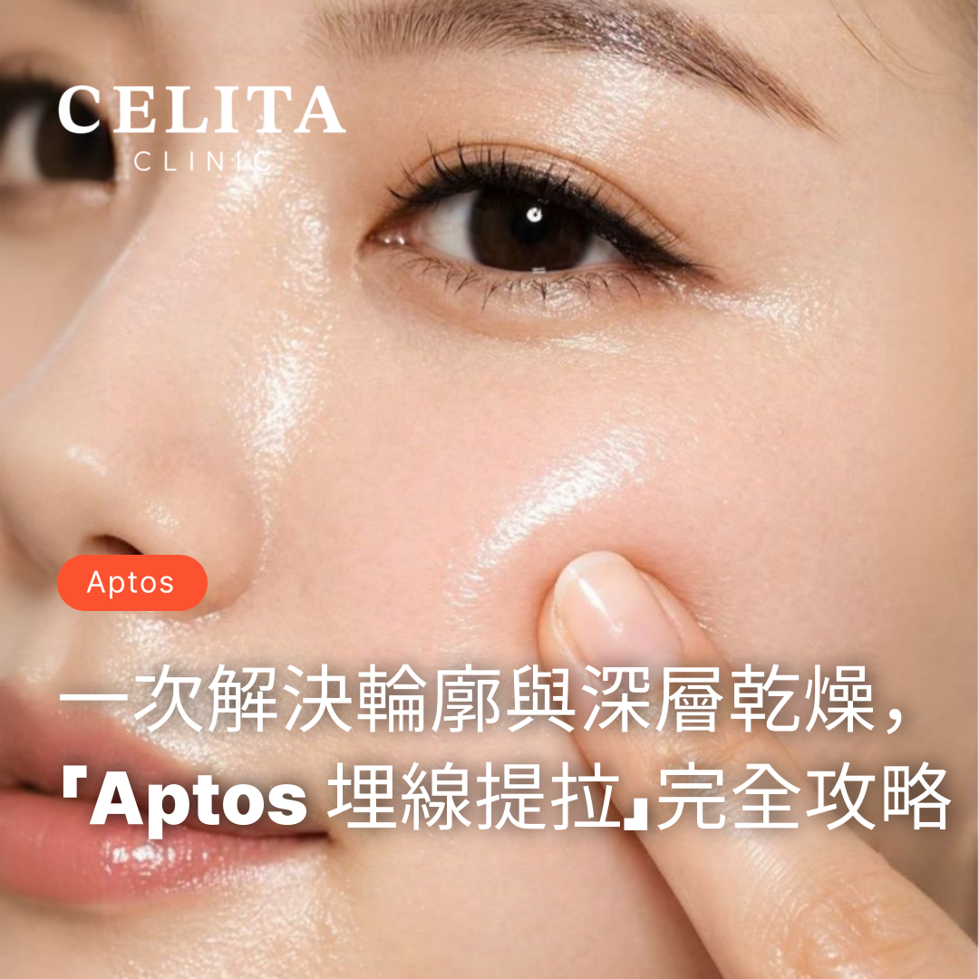 一次解決輪廓崩塌與深層乾燥，完全攻略第四代頂級「Aptos 埋線提拉」 