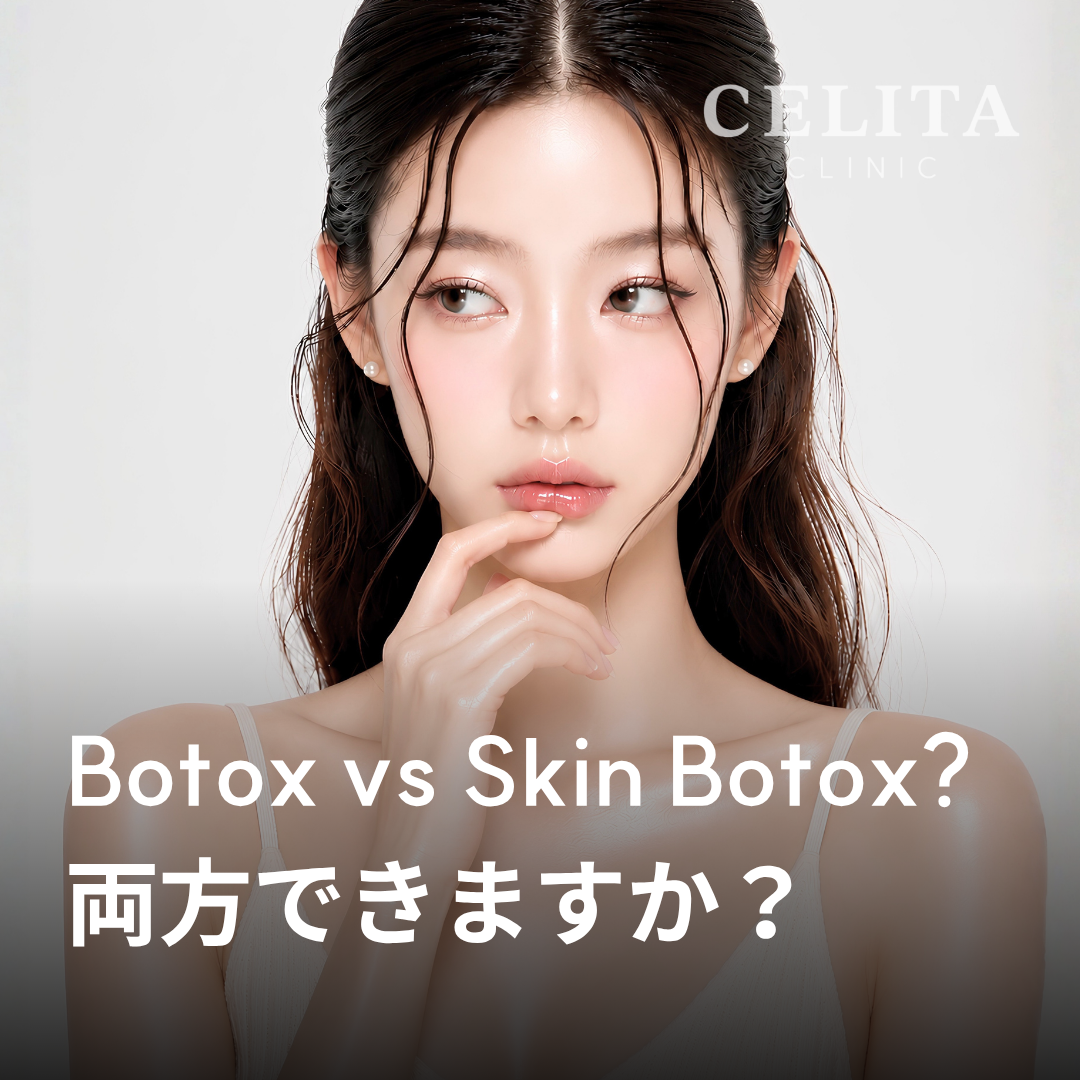 ボトックスとスキンボトックスの違い、選び方まとめ