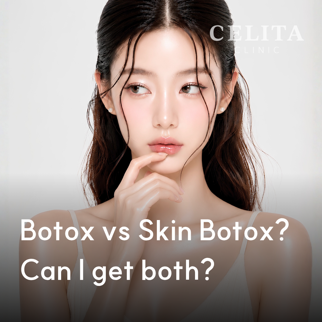 Botox vs Skin Botox: Differences and How to Choose
