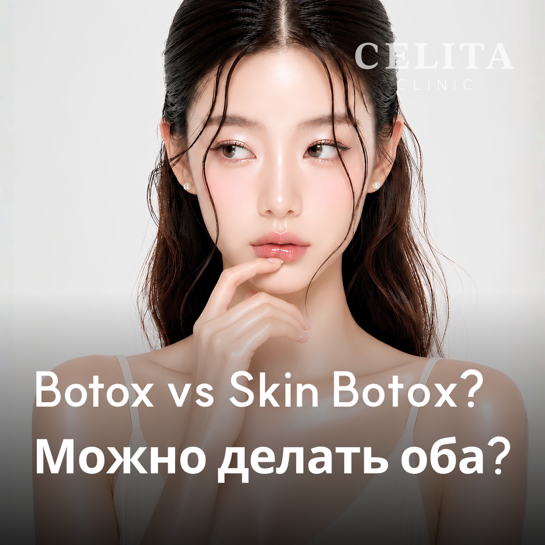 Ботокс и скин-ботокс: различия и критерии выбора