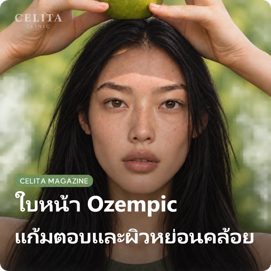 ดูแลใบหน้าระหว่างลดน้ำหนักด้วย Mounjaro และ Eppe ตามปัญหาแก้มตอบและผิวหย่อน