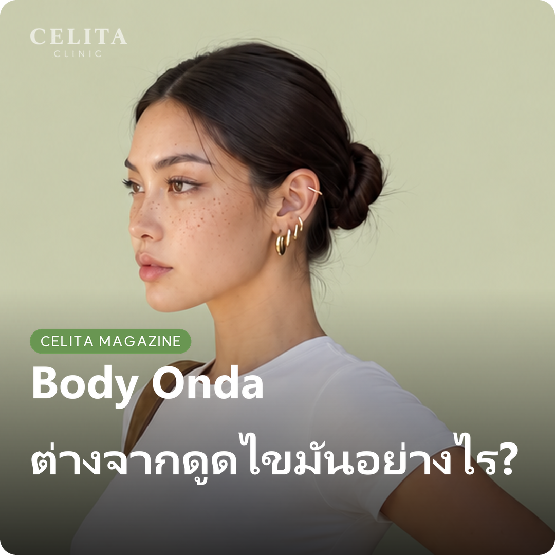 Body Onda: หลักการ ผลลัพธ์ ความต่างจากการดูดไขมัน และการดูแล
