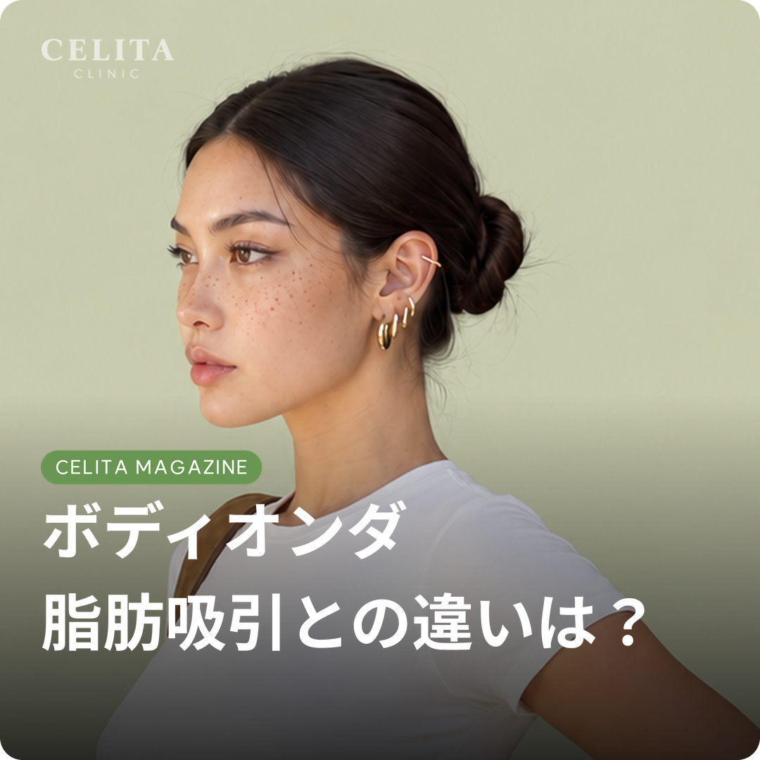 ボディオンダの仕組みと効果、脂肪吸引との違い、ケア方法