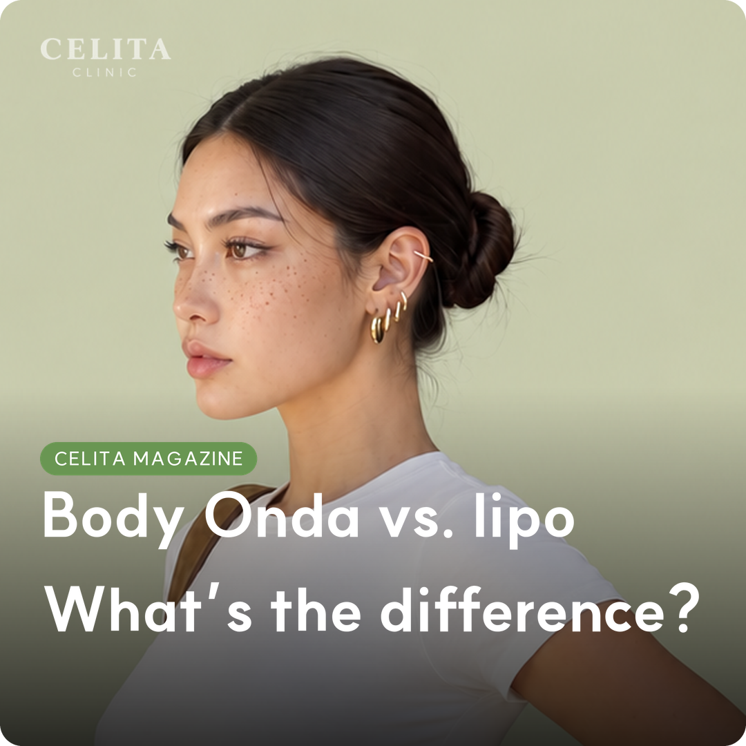Body Onda: How It Works, Effects, Liposuction Comparison and Aftercare