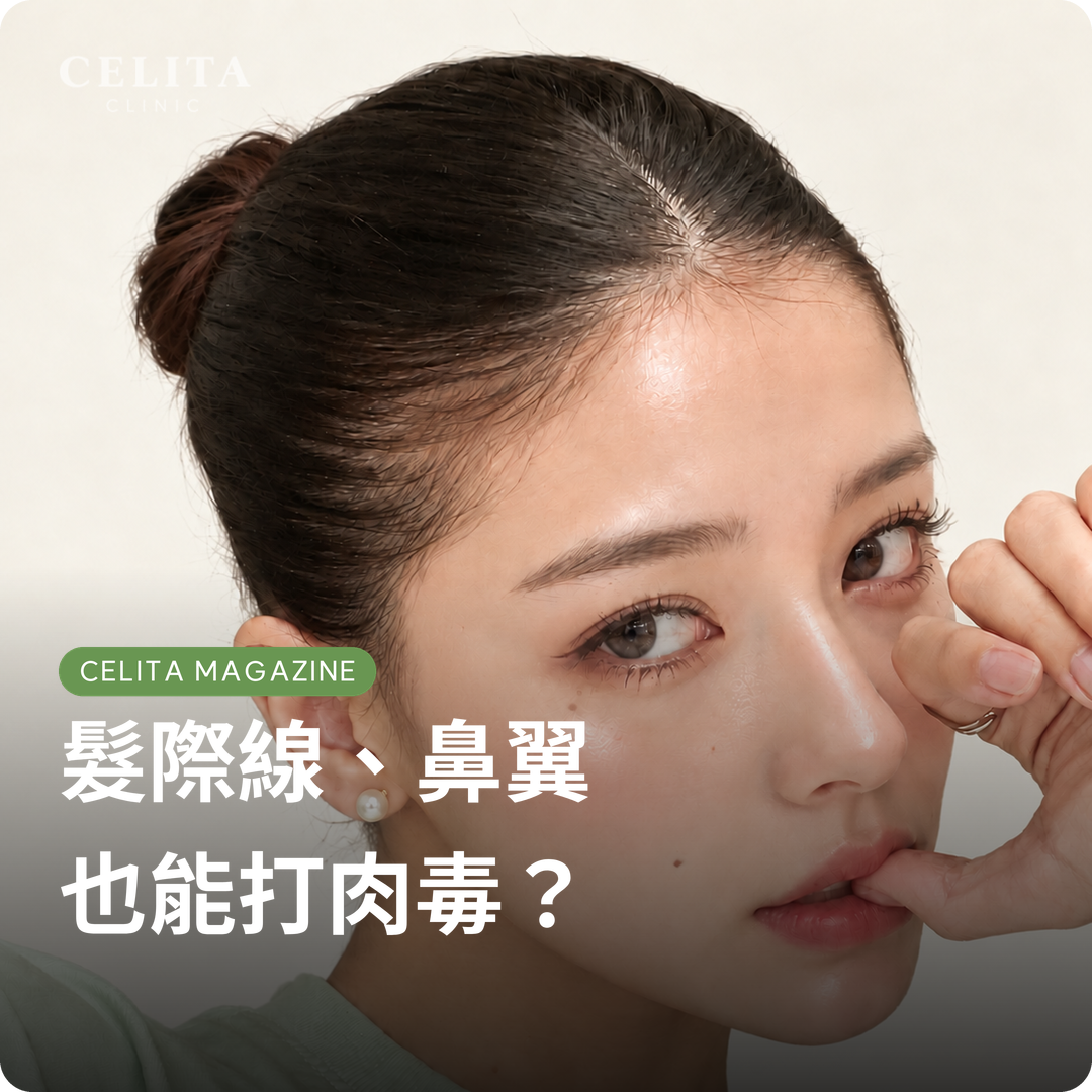 肉毒還只用於額頭皺紋和方形下顎嗎？