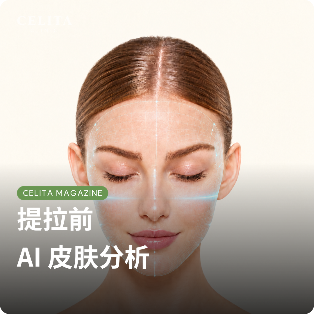 釜山提拉前AI皮肤分析：EVE V MUSE与SONO FINDER