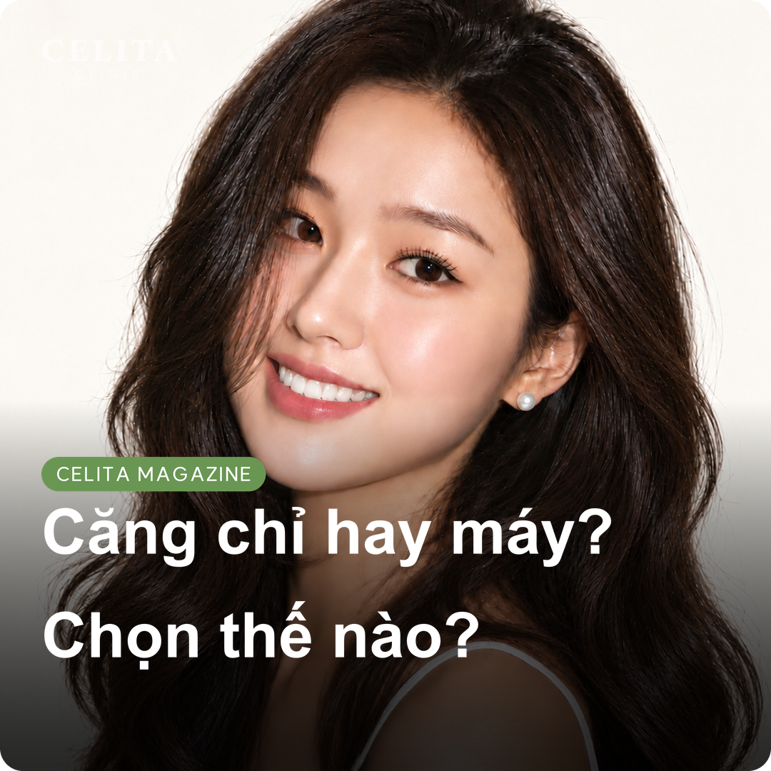 Mint Thread, Aptos Thread Lifting và nâng cơ bằng thiết bị: chọn ra sao?