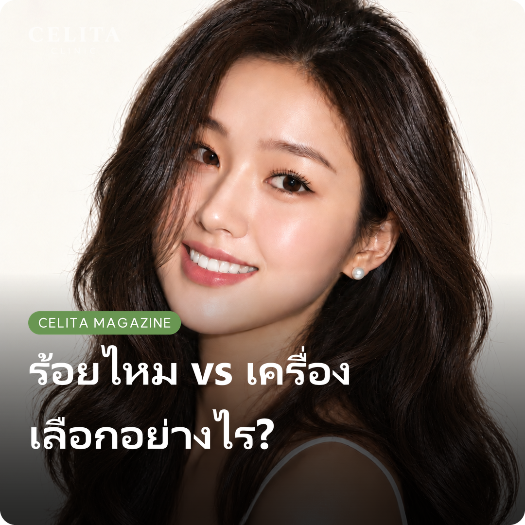Mint Thread, Aptos Thread Lifting และเครื่องยกกระชับ เลือกต่างกันอย่างไร?