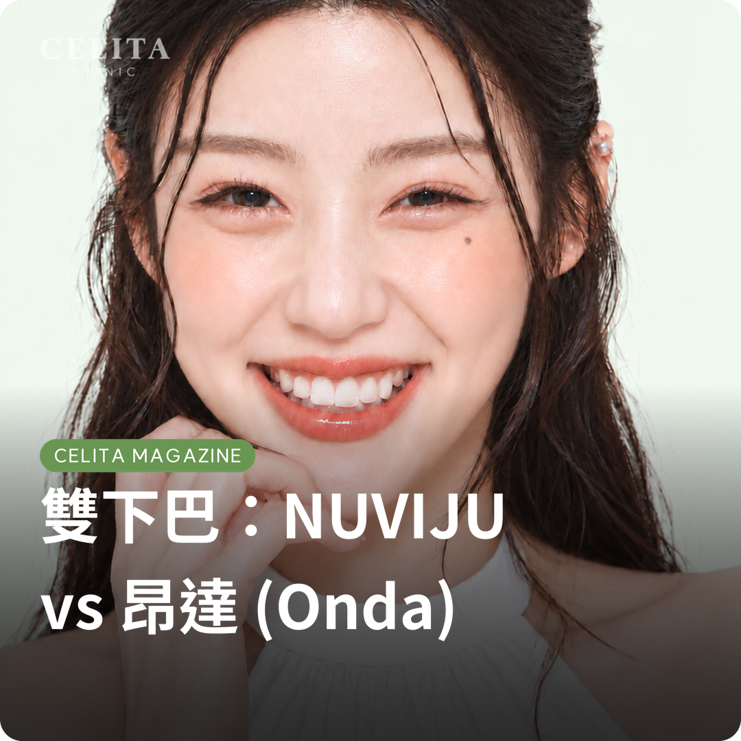 雙下巴管理，NUVIJU與昂達 (Onda) 有什麼不同？
