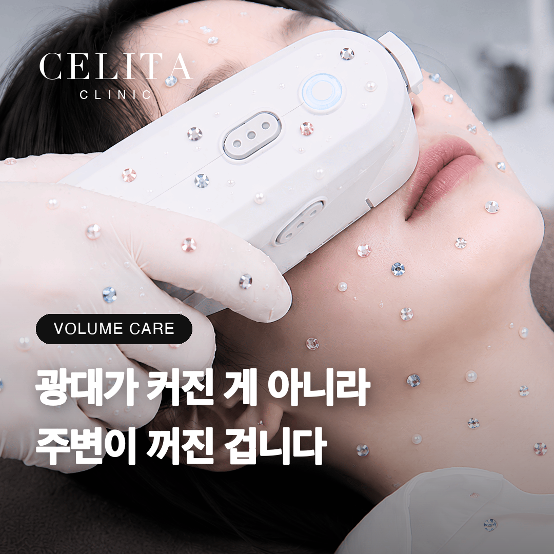 땅콩형 얼굴, 원인과 없애는 방법