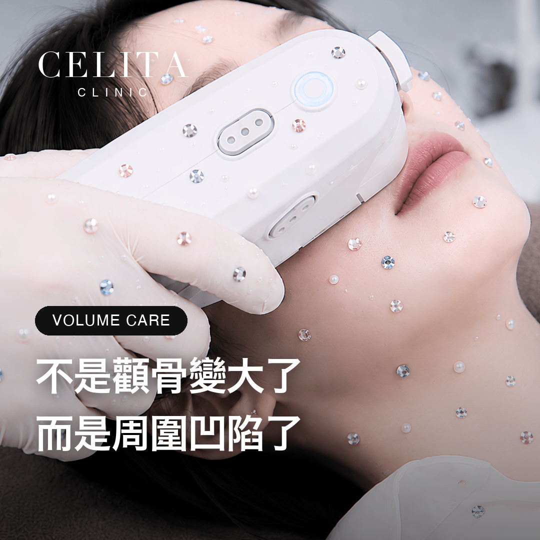 花生型臉部輪廓，成因與改善方向